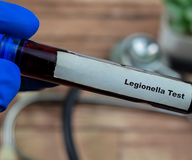 Vyhnite sa nebezpečenstvu v podobe Legionelly